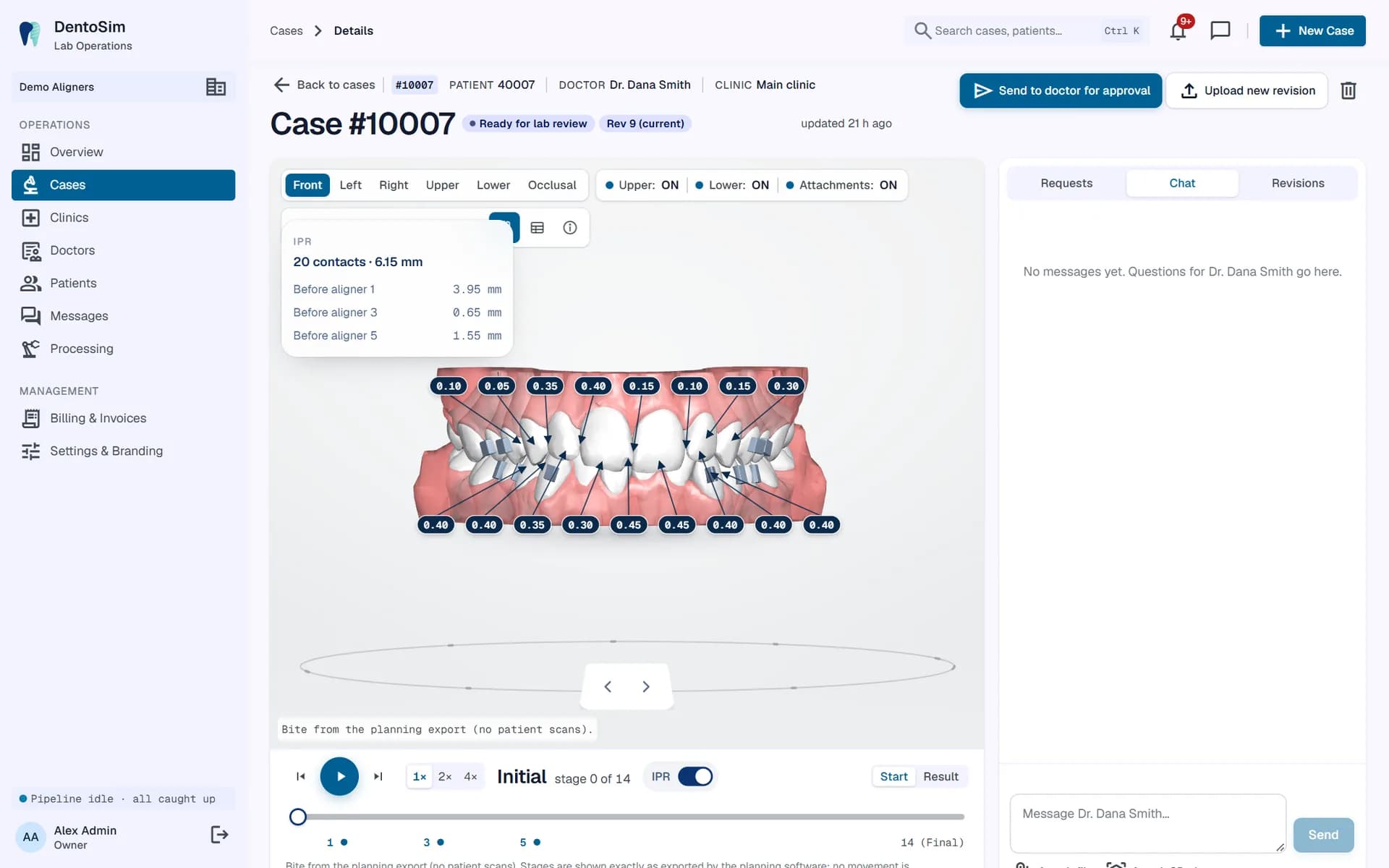 Orthodontic treatment plan viewer for the lab: an aligner case with IPR values, the IPR protocol, playback and chat with the doctor